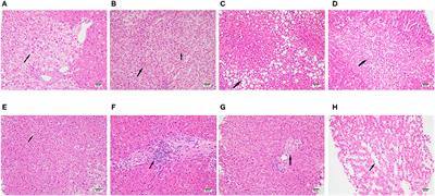 Liver Histopathological Analysis of 24 Postmortem Findings of Patients With COVID-19 in China
